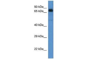 Human 721_B; WB Suggested Anti-ACAD9 Antibody. (ACAD9 Antikörper  (C-Term))