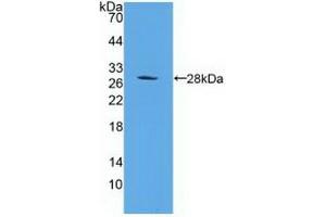 Western Blotting (WB) image for anti-Proteasome (Prosome, Macropain) 26S Subunit, Non-ATPase, 10 (PSMD10) (AA 1-226) antibody (ABIN7441721)