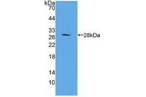 Detection of Recombinant PSMD10, Human using Polyclonal Antibody to Proteasome 26S Subunit, Non ATPase 10 (PSMD10) (PSMD10 Antikörper  (AA 1-226))
