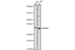 Western blot analysis of extracts of various cell lines, using EIF4E2 antibody (ABIN6130366, ABIN6140086, ABIN6140087 and ABIN6220578) at 1:1000 dilution. (EIF4E2 Antikörper  (AA 1-240))