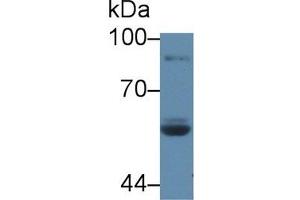 Detection of LPO in Human Saliva using Polyclonal Antibody to Lactoperoxidase (LPO) (LPO Antikörper  (AA 351-589))