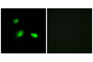 Immunofluorescence analysis of A549 cells, using HSPB2 antibody.