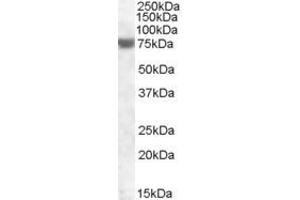 Western Blotting (WB) image for anti-Fem-1 Homolog A (FEM1A) (AA 656-669) antibody (ABIN490527) (FEM1A Antikörper  (AA 656-669))