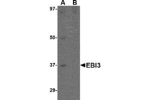 Western blot analysis of EBI3 in K562 lysate with AP30306PU-N EBI3 antibody at 1 μg/ml in (A) the absence and (B) the presence of blocking peptide. (EBI3 Antikörper  (C-Term))