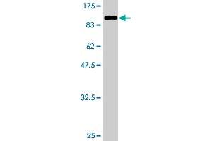 Western Blotting (WB) image for anti-Protein Phosphatase 2, Regulatory Subunit B', delta (PPP2R5D) (AA 1-602) antibody (ABIN519129)