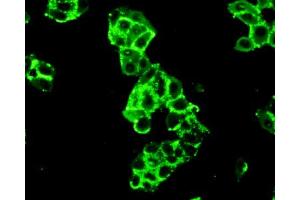 Figure:FITC staining on IHC-P Simple: Mcf7 cells (Hexokinase 2 Antikörper  (AA 619-917))
