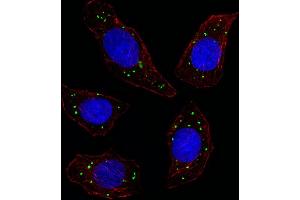 Fluorescent image of U251 cell stained with MERTK Antibody. (MERTK Antikörper)