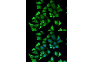 Immunofluorescence analysis of A549 cells using ENTPD2 antibody. (ENTPD2 Antikörper)