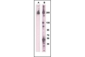 Western blot analysis of RK8 (LRRK2) (arrow) using rabbit polyclonal RK8 (LRRK2)Antibody  g. (LRRK2 Antikörper  (AA 931-962))