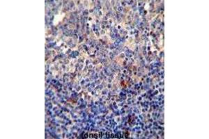 Immunohistochemistry (IHC) image for anti-B-Cell CLL/lymphoma 10 (BCL10) antibody (ABIN2995789) (BCL10 Antikörper)