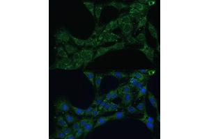 Immunofluorescence analysis of C6 cells using ETFB Polyclonal Antibody (ABIN7266916) at dilution of 1:100 (40x lens). (ETFB Antikörper  (AA 80-230))