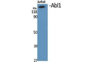 Western Blot (WB) analysis of specific cells using Abl1 Polyclonal Antibody.