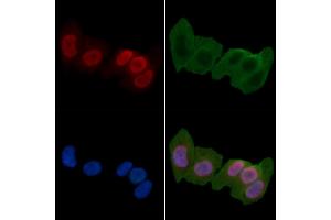 ABIN6266176 and ABIN6277195 staining Hela cells(24h of starvation treatment) by IF/ICC.