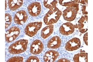 Immunohistochemistry (IHC) image for anti-Keratin 20 (KRT20) (AA 196-323) antibody (ABIN6940346)