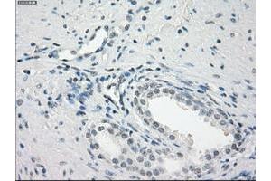 Image no. 5 for anti-Fc Fragment of IgG, Low Affinity IIa, Receptor (CD32) (FCGR2A) antibody (ABIN1497263)