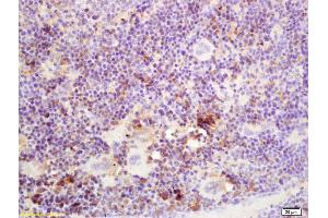 Formalin-fixed and paraffin embedded mouse spleen labeled with Rabbit Anti SSA/52KDa Ro3 Polyclonal Antibody, Unconjugated (ABIN671196) at 1:200 followed by conjugation to the secondary antibody and DAB staining