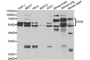 Western blot analysis of extracts of various cell lines, using CD36 antibody. (CD36 Antikörper)