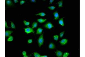 Immunofluorescence staining of A549 cells with ABIN7160609 at 1:200, counter-stained with DAPI. (MYBPC1 Antikörper  (AA 618-779))