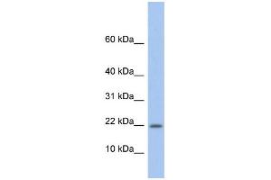 WB Suggested Anti-NDP Antibody Titration: 0. (Norrie Disease (Pseudoglioma) Antikörper  (Middle Region))