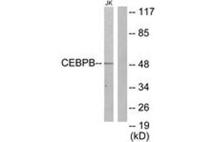 Western blot analysis of extracts from Jurkat cells, using CEBPB Antibody. (CEBPB Antikörper  (AA 231-280))