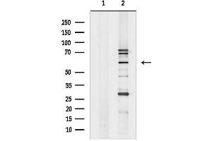 Western blot analysis of lysates from P19 cells, using ER81 Antibody.