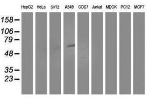 Image no. 2 for anti-Aldehyde Dehydrogenase 3 Family, Member A2 (ALDH3A2) antibody (ABIN1496596) (ALDH3A2 Antikörper)