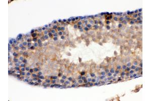 Immunohistochemistry (Paraffin-embedded Sections) (IHC (p)) image for anti-Isocitrate Dehydrogenase 1 (NADP+), Soluble (IDH1) (AA 381-413), (C-Term) antibody (ABIN3043855) (IDH1 Antikörper  (C-Term))