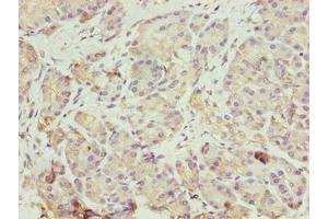 Immunohistochemistry of paraffin-embedded human pancreatic tissue using ABIN7152004 at dilution of 1:100 (ERO1LB Antikörper  (AA 101-400))