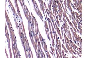 Detection of NPPA in Rat Heart Tissue using Polyclonal Antibody to Natriuretic Peptide Precursor A (NPPA) (NPPA Antikörper  (AA 25-152))