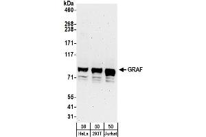anti-rho GTPase Activating Protein 26 (ARHGAP26) (AA 611-661) antibody