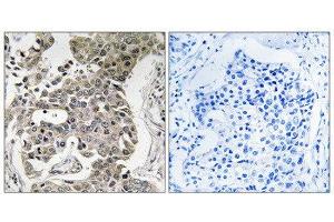 Immunohistochemistry (IHC) image for anti-Protein Phosphatase 2, Regulatory Subunit A, beta (PPP2R1B) (C-Term) antibody (ABIN1852118) (PPP2R1B Antikörper  (C-Term))
