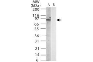 Western blot analysis of mouse Trl12 in (A) transfected and (B) untransfected cell lysate using Trl12 monoclonal antibody, clone 15F1215  at 1:1000. (TLR12 Antikörper  (AA 791-806))