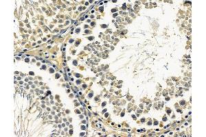 ABIN7096615 and ABIN7100679 at 1/100 staining rat testis tissue by IHC-P. (ARMC9 Antikörper)