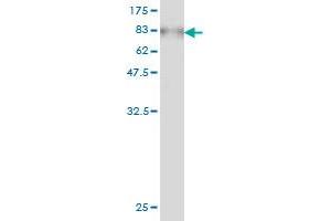 Western Blot detection against Immunogen (78. (AKT1 Antikörper  (AA 1-480))