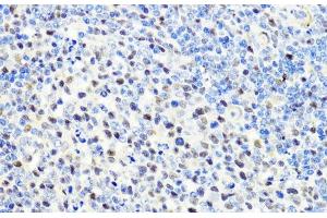 Immunohistochemistry of paraffin-embedded Rat spleen using CTCF Polyclonal Antibody at dilution of 1:100 (40x lens). (CTCF Antikörper)