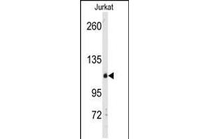 Western blot analysis of anti-anti-DGK delta Pab in Jurkat cell line lysates (35ug/lane) (DGKD Antikörper  (C-Term))