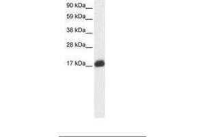 Image no. 2 for anti-E2F Transcription Factor 6 (E2F6) (AA 43-92) antibody (ABIN6735865) (E2F6 Antikörper  (AA 43-92))