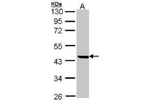 Western Blotting (WB) image for anti-serpin Peptidase Inhibitor, Clade B (Ovalbumin), Member 1 (SERPINB1) (Center) antibody (ABIN2855844)