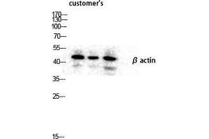 Western Blot (WB) analysis of lysis using Actin beta antibody. (beta Actin Antikörper  (N-Term))