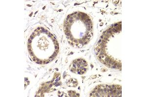 Immunohistochemistry of paraffin-embedded human mammary gland using HDAC5 antibody. (HDAC5 Antikörper)