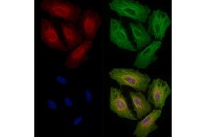 ABIN6257331 and ABIN6275242 staining  cells by IF/ICC. (MRPL3 Antikörper  (N-Term))