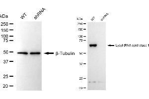 Western blotting analysis using lysyl-tRNA synthetase 1 antibody (ABIN7800951).
