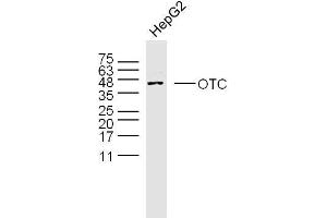 Human HepG2 cells probed with OTC Polyclonal Antibody, unconjugated  at 1:300 overnight at 4°C followed by a conjugated secondary antibody at 1:10000 for 90 minutes at 37°C. (OTC Antikörper  (AA 51-150))