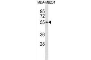 Western Blotting (WB) image for anti-Pepsinogen 3, Group I (Pepsinogen A) (PGA3) antibody (ABIN2995164) (PGA3 Antikörper)