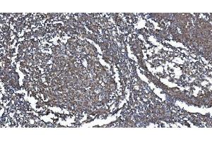 Figure 3 IHC analysis of METTL3 using anti-METTL3 antibody (ABIN7602366).