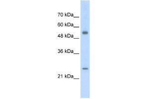 WB Suggested Anti-AK3L1 Antibody Titration:  2. (AK4 Antikörper  (Middle Region))