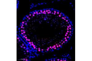 Immunofluorescence of paraffin embedded rat testis using SCP1 (ABIN7075786) at dilution of 1:500 (300x lens) (SYCP1 Antikörper)