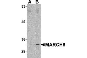 Western Blotting (WB) image for anti-Membrane-Associated Ring Finger (C3HC4) 8, E3 Ubiquitin Protein Ligase (MARCH8) (C-Term) antibody (ABIN1030506) (MARCH8 Antikörper  (C-Term))