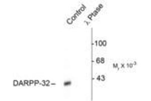 Image no. 1 for anti-Protein Phosphatase 1, Regulatory (Inhibitor) Subunit 1B (PPP1R1B) (pThr34) antibody (ABIN228688)