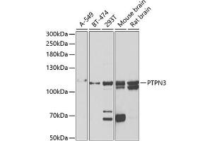 Western blot analysis of extracts of various cell lines, using PTPN3 antibody (ABIN6132535, ABIN6146448, ABIN6146449 and ABIN6222030) at 1:1000 dilution. (PTPN3 Antikörper  (AA 1-300))